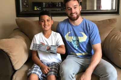 U of G Student’s Low-Cost Prosthetic Hand Changing Lives