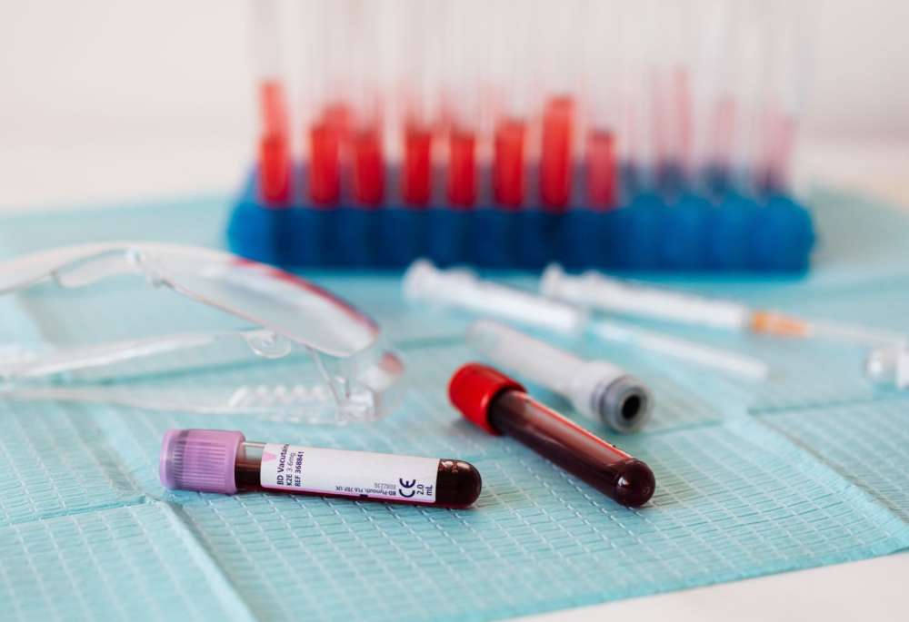 Vials of blood are shown