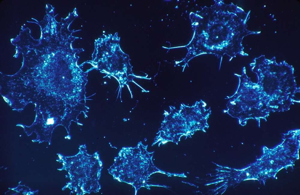 A blue illustration of cancer cells
