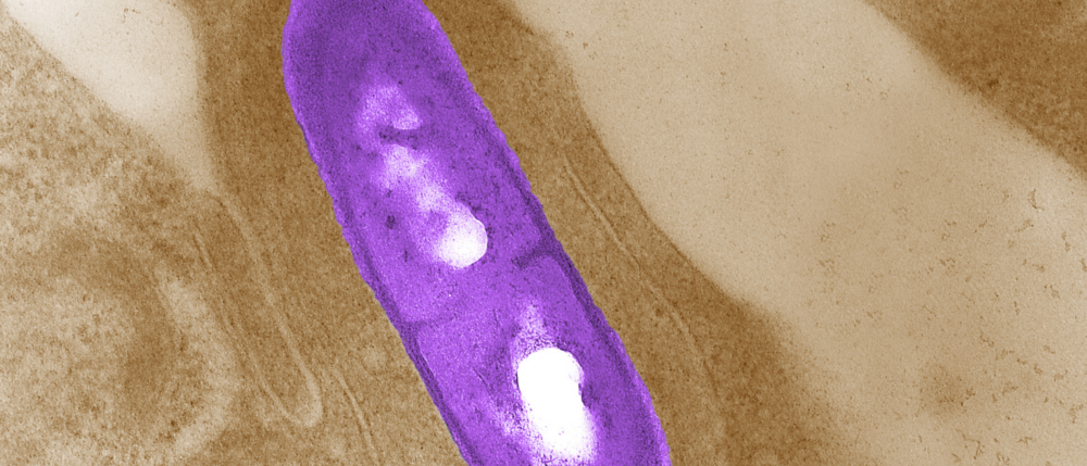 microscopic photo of a purple oblong listeria bacteria on a brown background