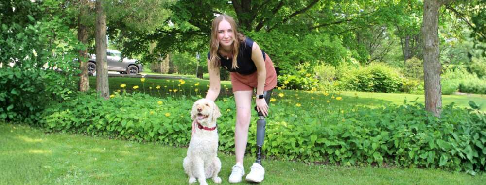 Person with prosthetic leg poses with dog against greenery